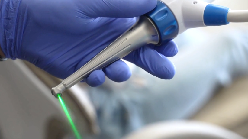 Close-up for the Solea® All-Tissue Dental Laser emitting a green laser in a dental setting