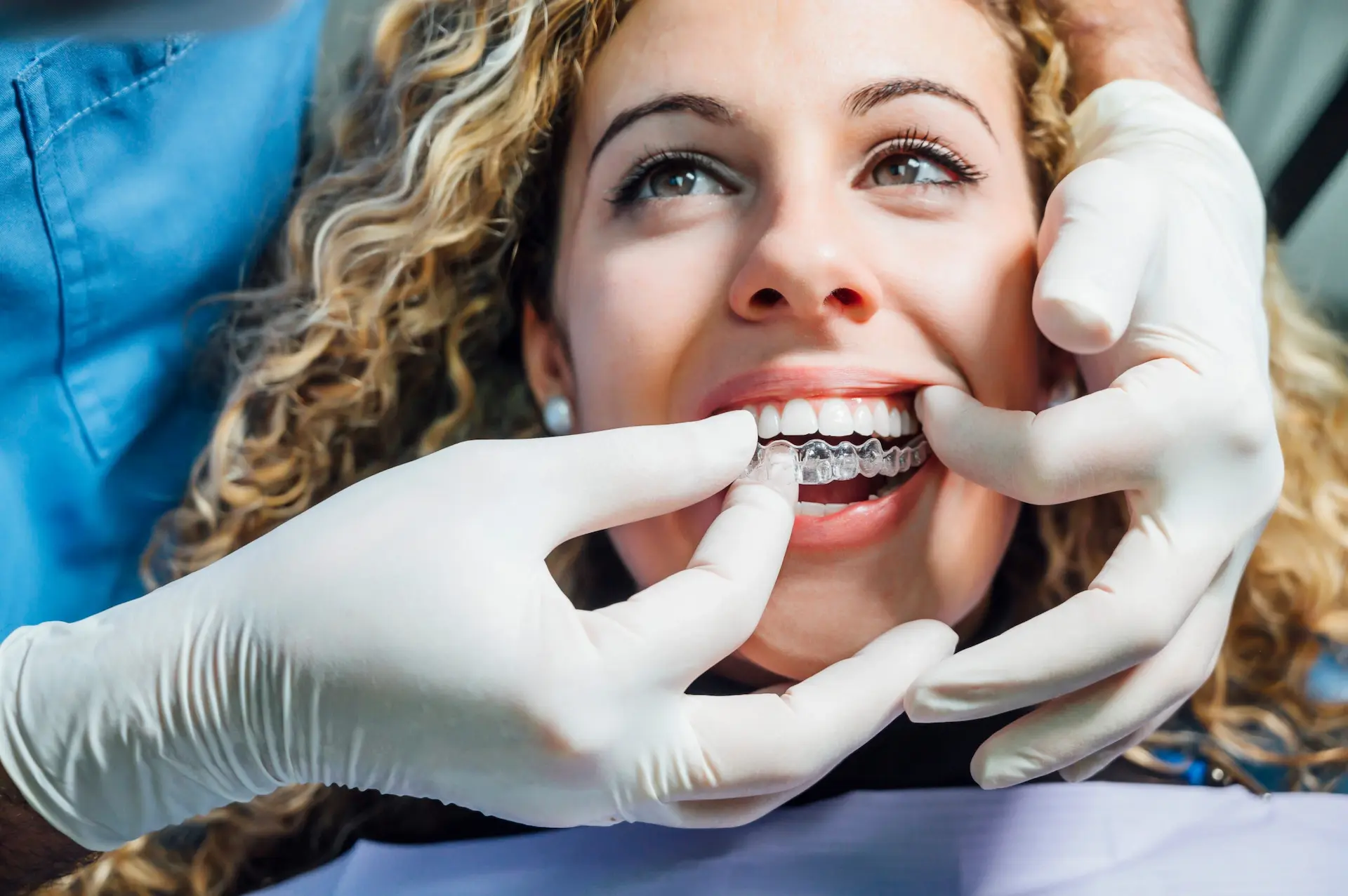 Clear aligners Invisalign Houston Washington