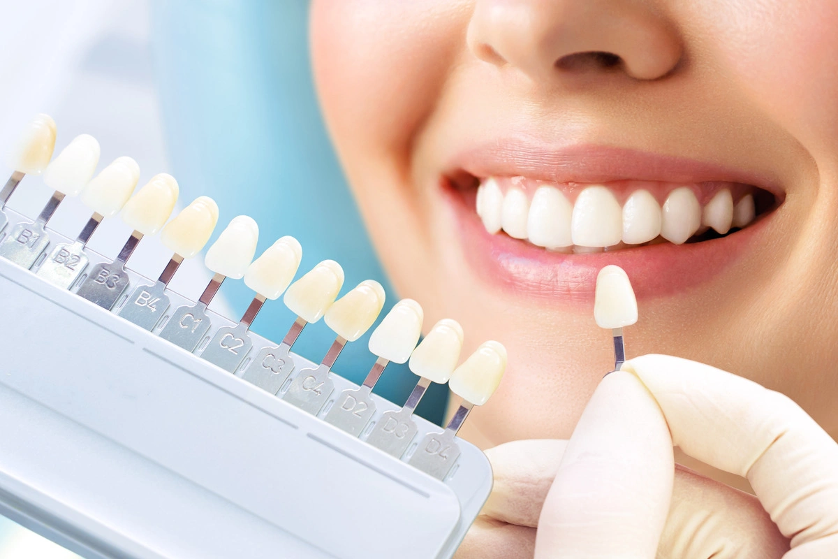 Cosmetic dentistry veneers smile makeover Greater Heights Houston